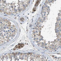 CLCN2 Antibody, Novus Biologicals 0.1mL; Unlabeled:Antibodies, Polyclonal